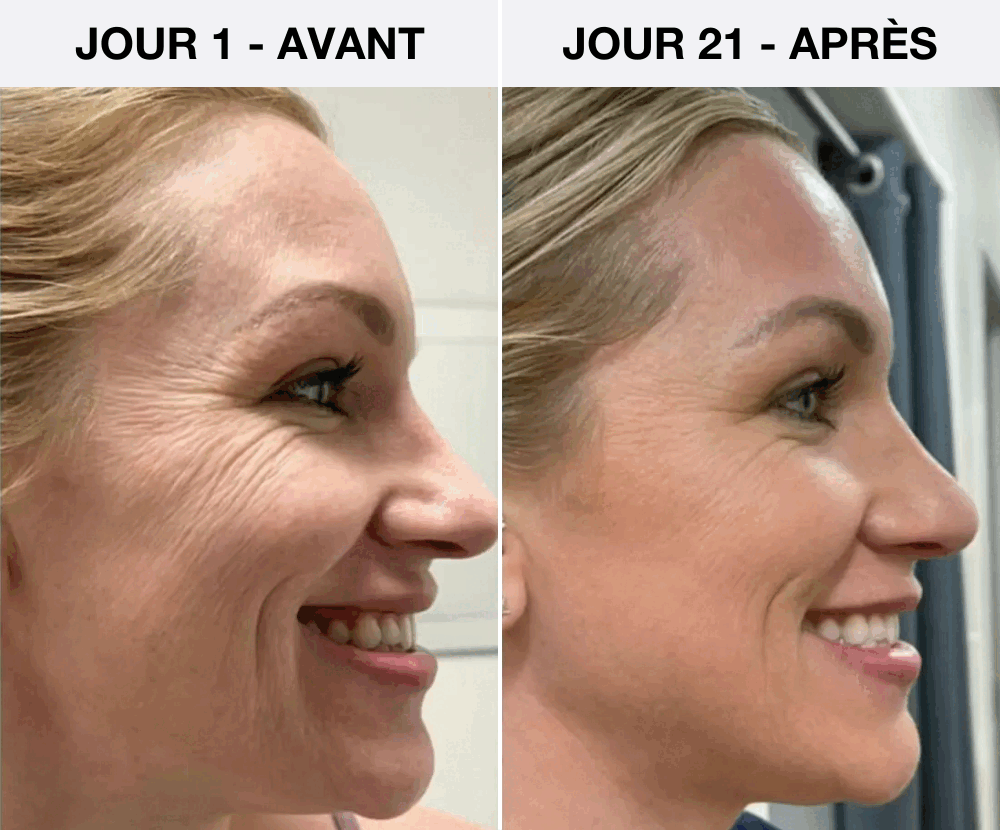 GlowWave Facial Revitalizer