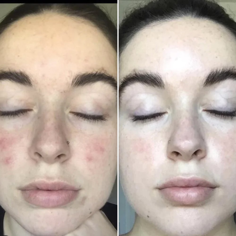 GlowWave Facial Revitalizer